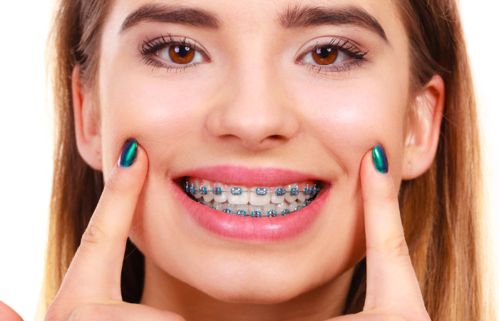  dental braces treatment clinic